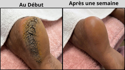 Baume Miracle Réparateur Pieds et Mains