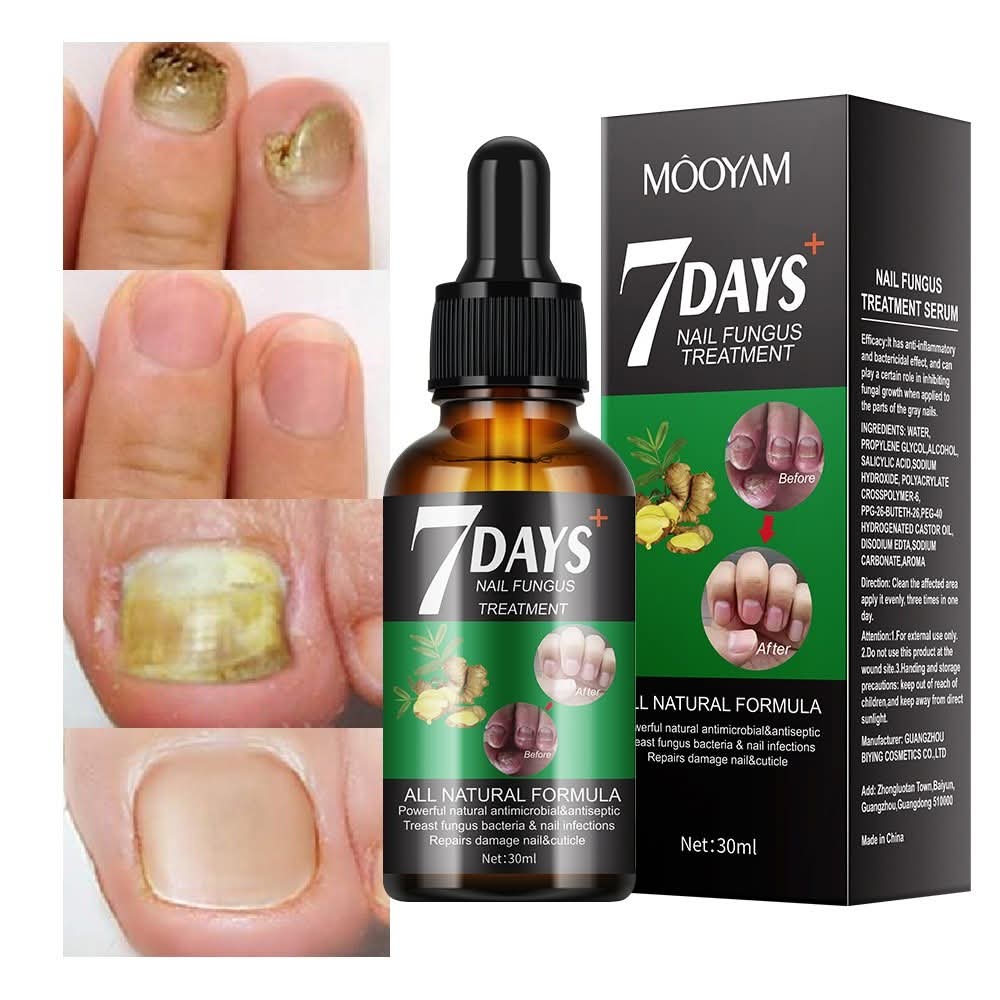 Sérum naturel - Traitement des mycoses des ongles