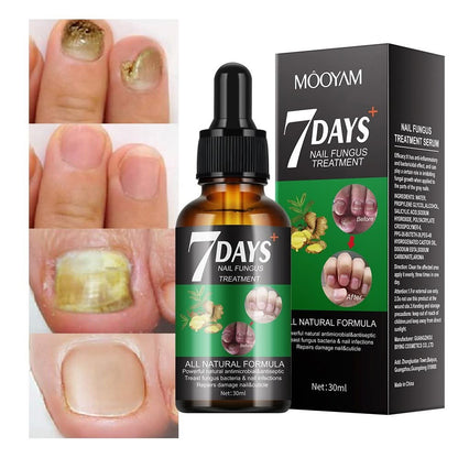 Sérum naturel - Traitement des mycoses des ongles