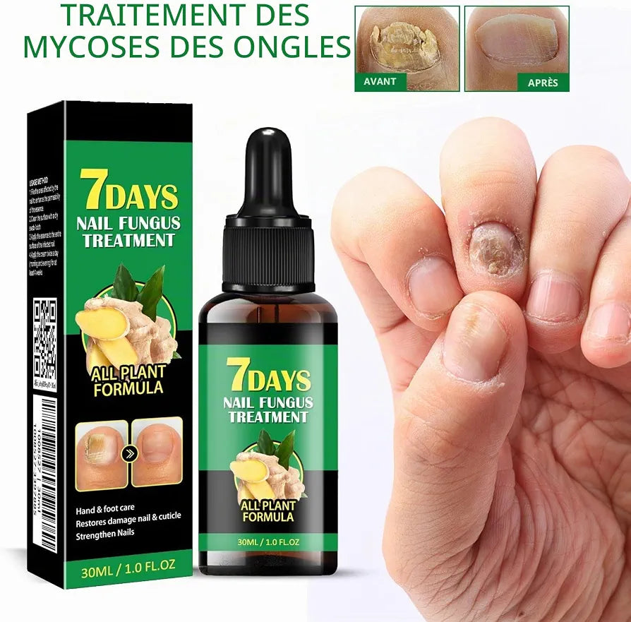 Sérum naturel - Traitement des mycoses des ongles