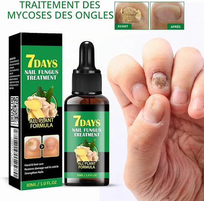 Sérum naturel - Traitement des mycoses des ongles